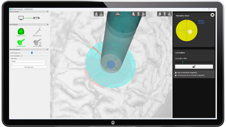 MRI-free Navigation