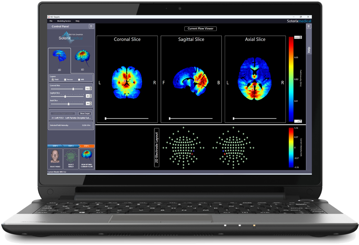 Soterix Medical home tDCS / tES webinar