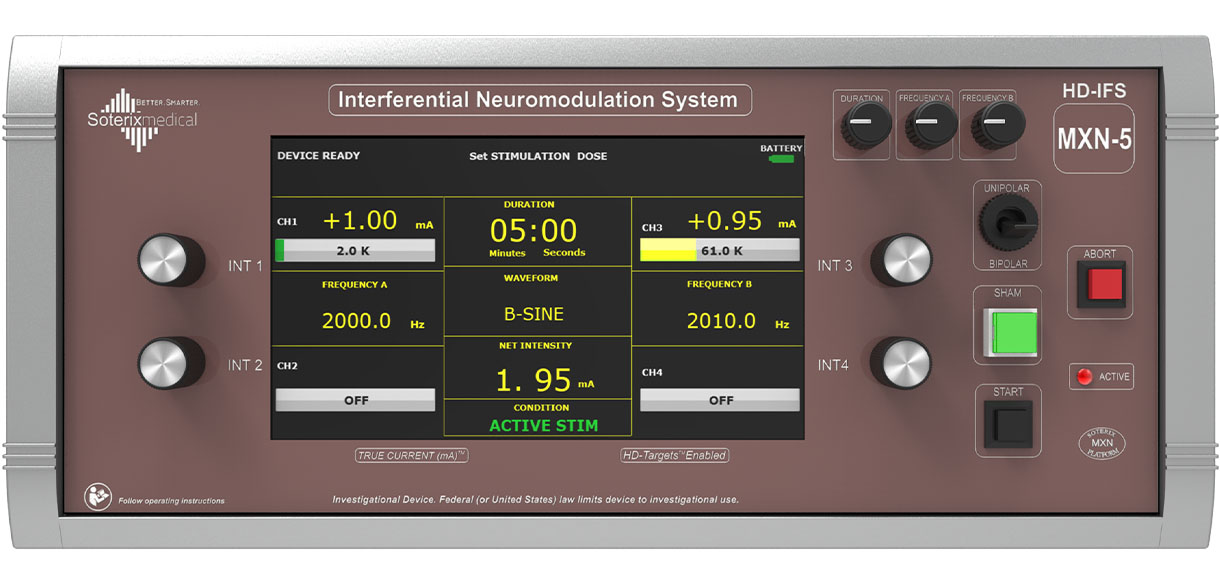 Interferential Stimulation