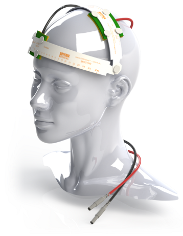 What is tDCS