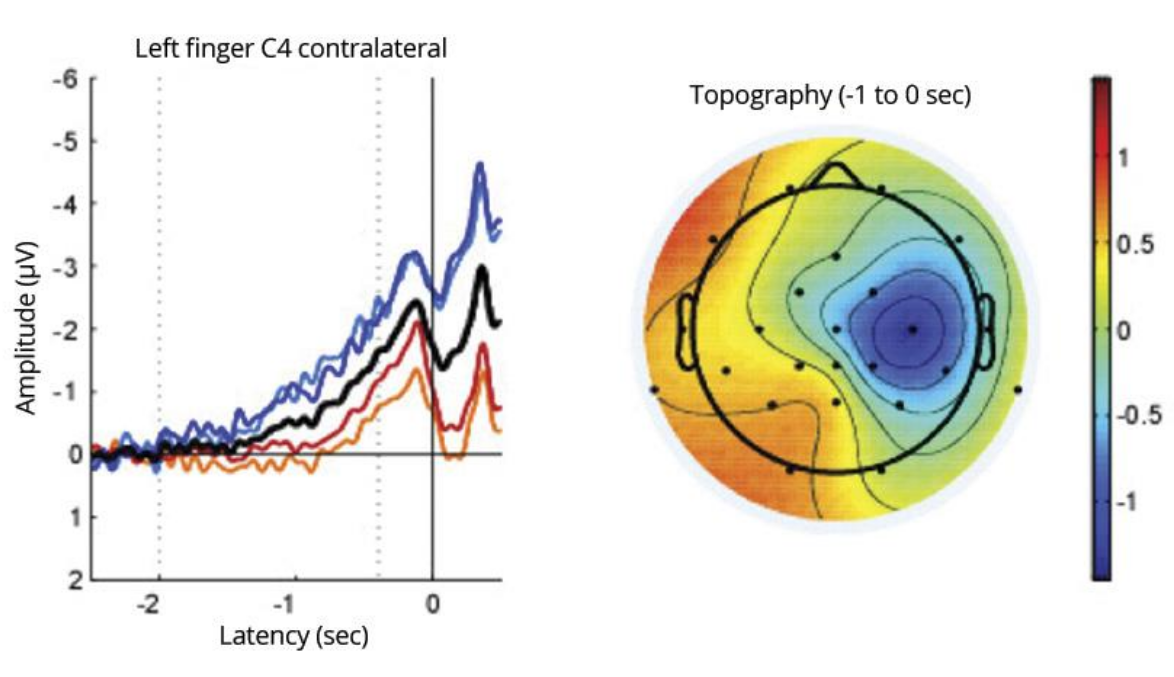 Soterix Medical Mobile EEG High quality ERP recordings