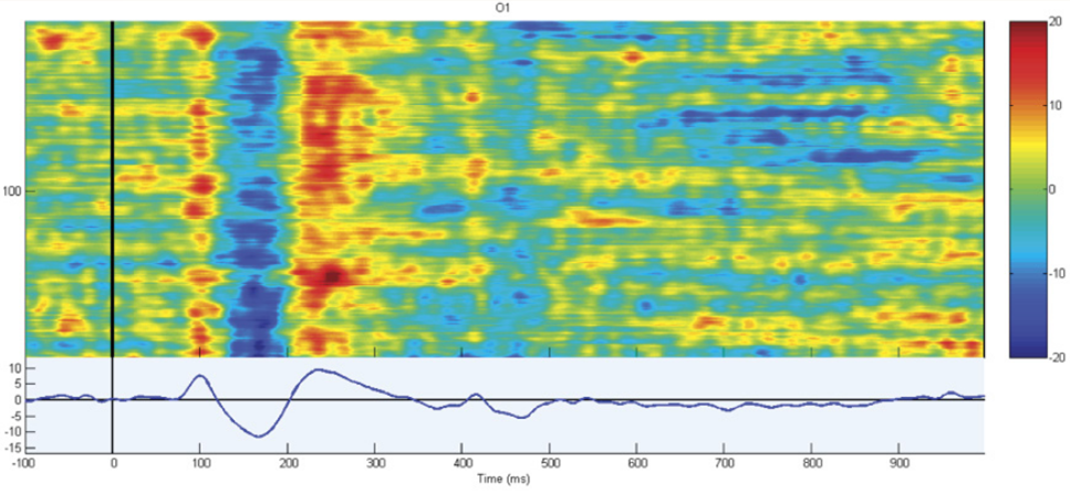 Soterix Medical Mobile EEG High quality ERP recordings