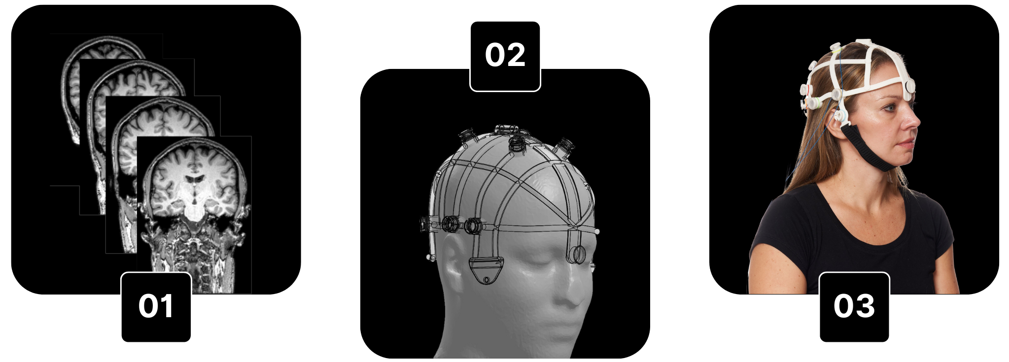 PrecisionHD Procedure Steps