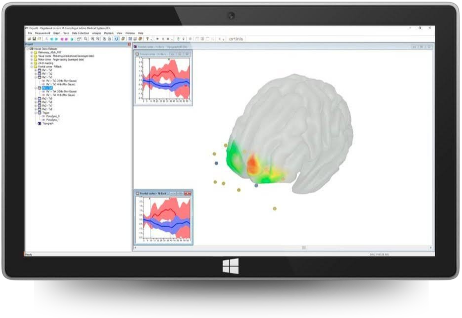 Real-time processing of fNIRS data in 3D