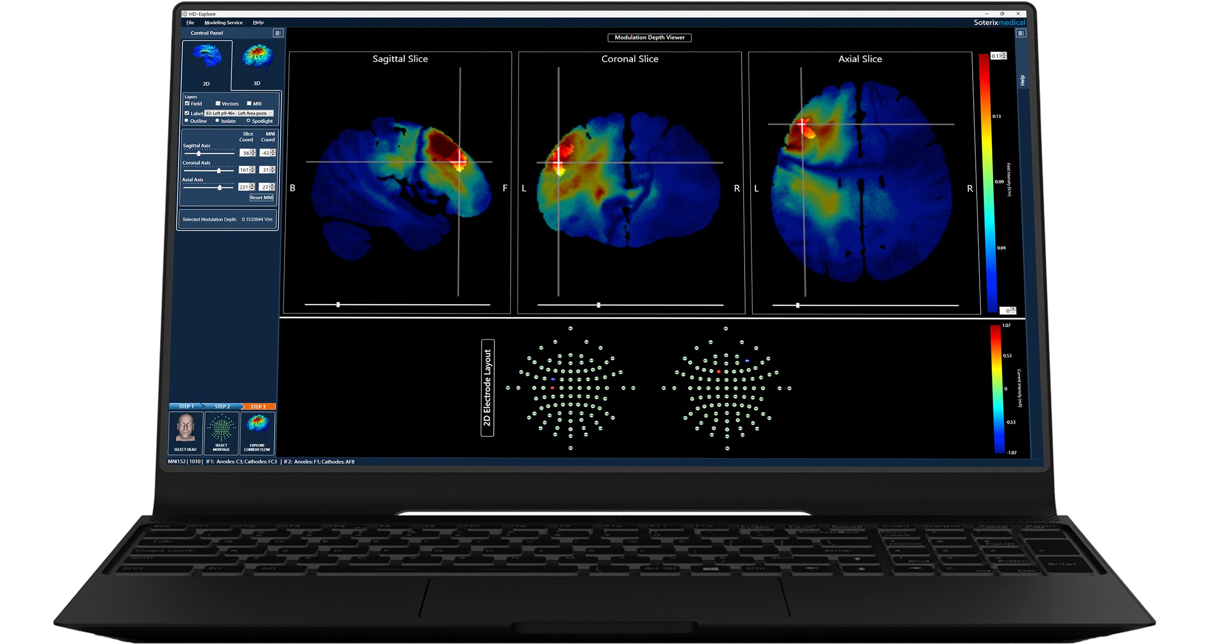 HD-Explore software on Laptop