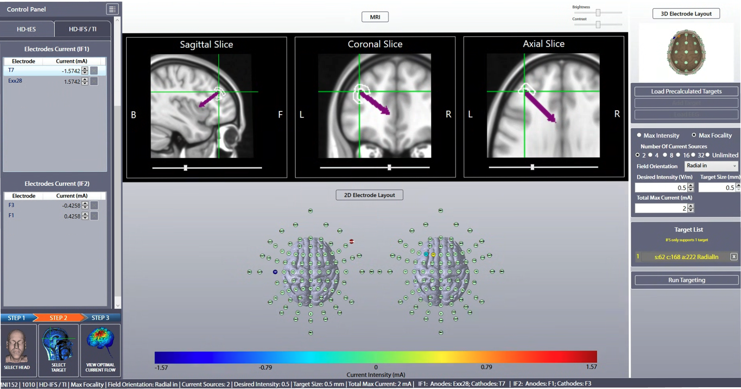 Step 2 Target region and stimulation paratmeters slection