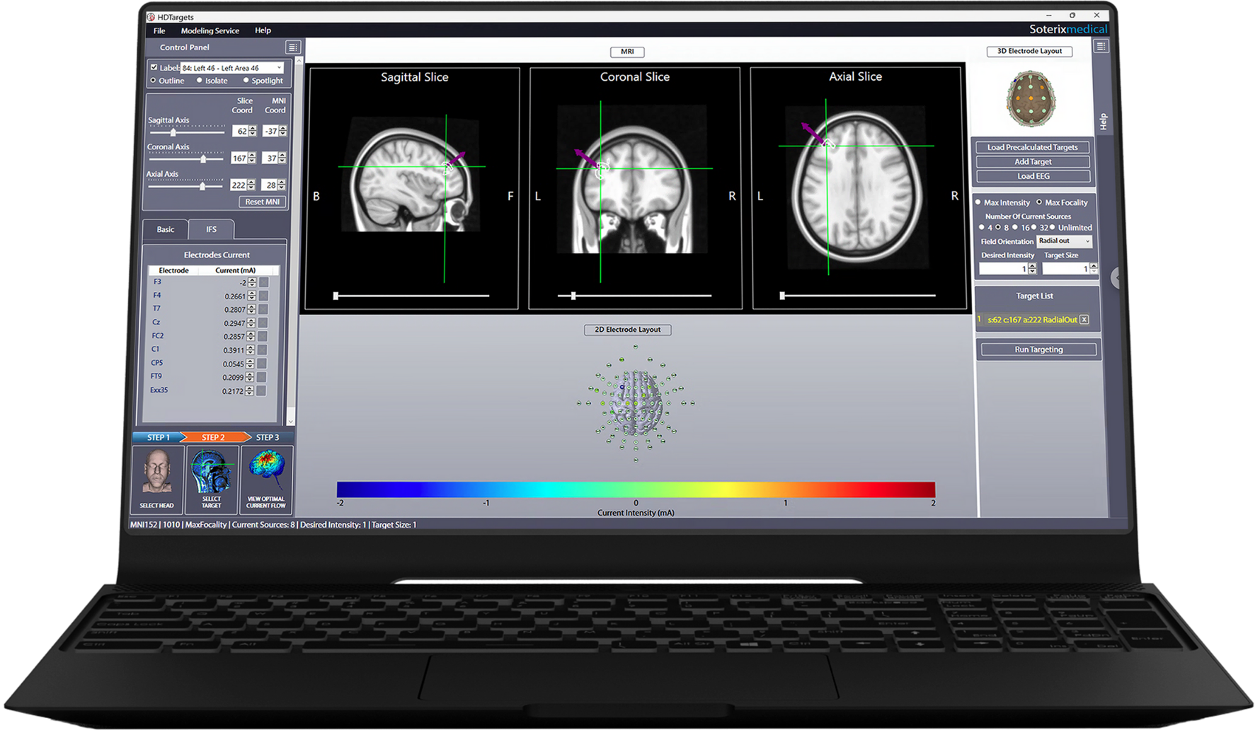 HD-Targetse software on Laptop