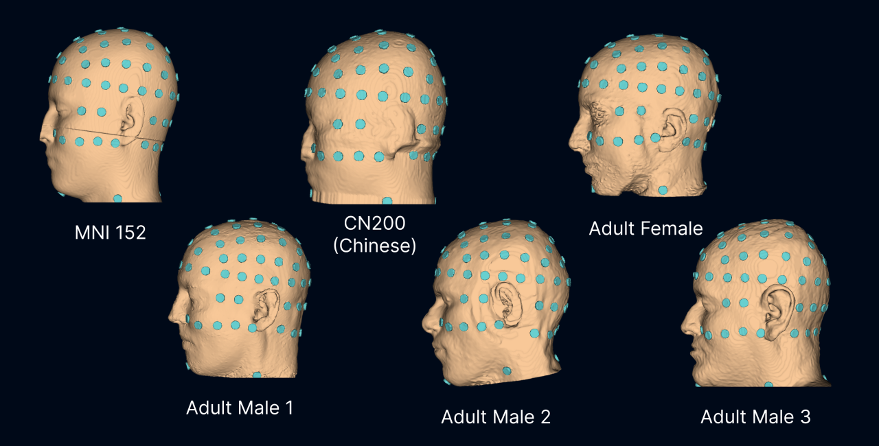 Step 1 Head and Electrode Model Selection