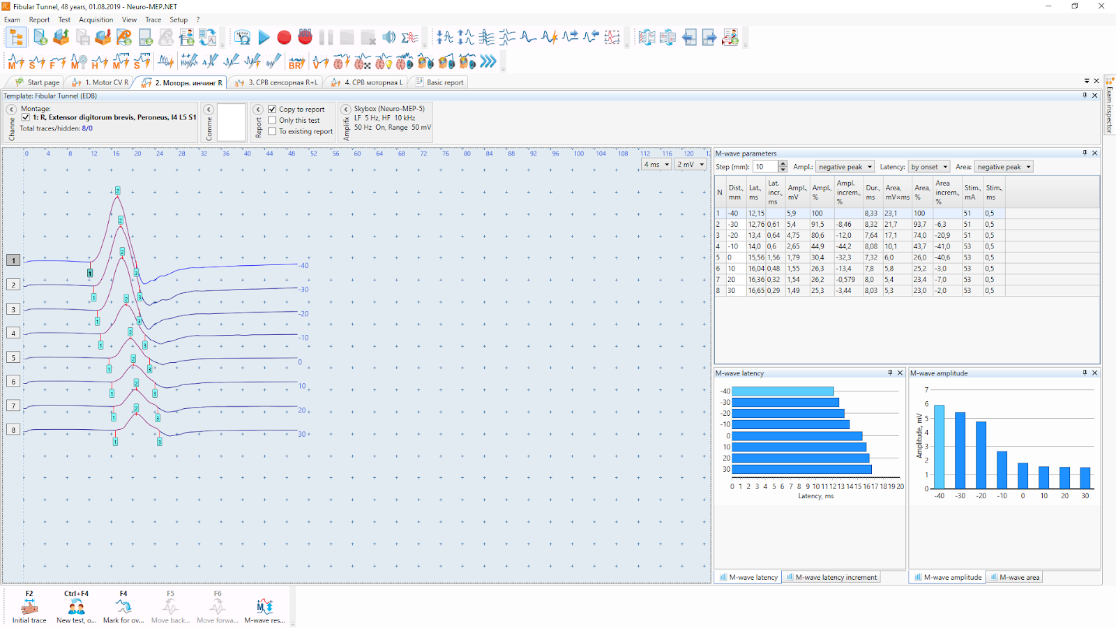 State of the art software (NEURO-MEP.NET)