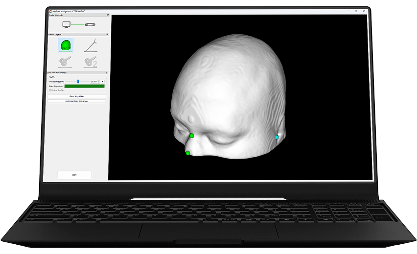 MRI-free Navigation